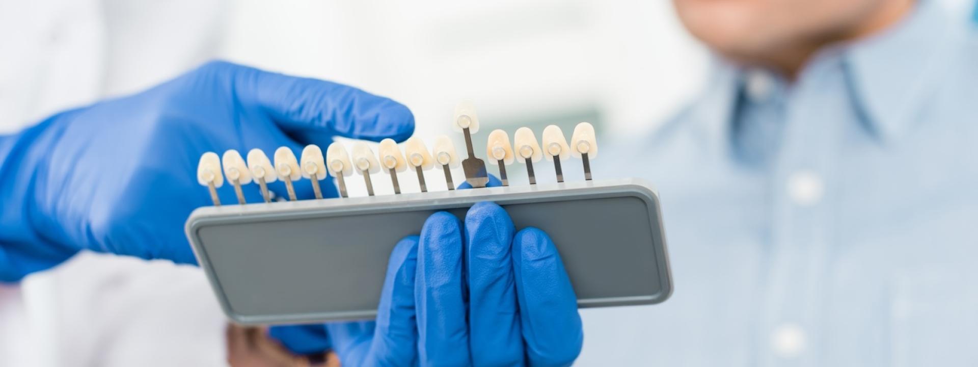 Dental Implants options